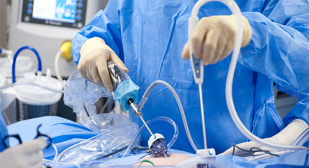 quistectomia_laparoscopica